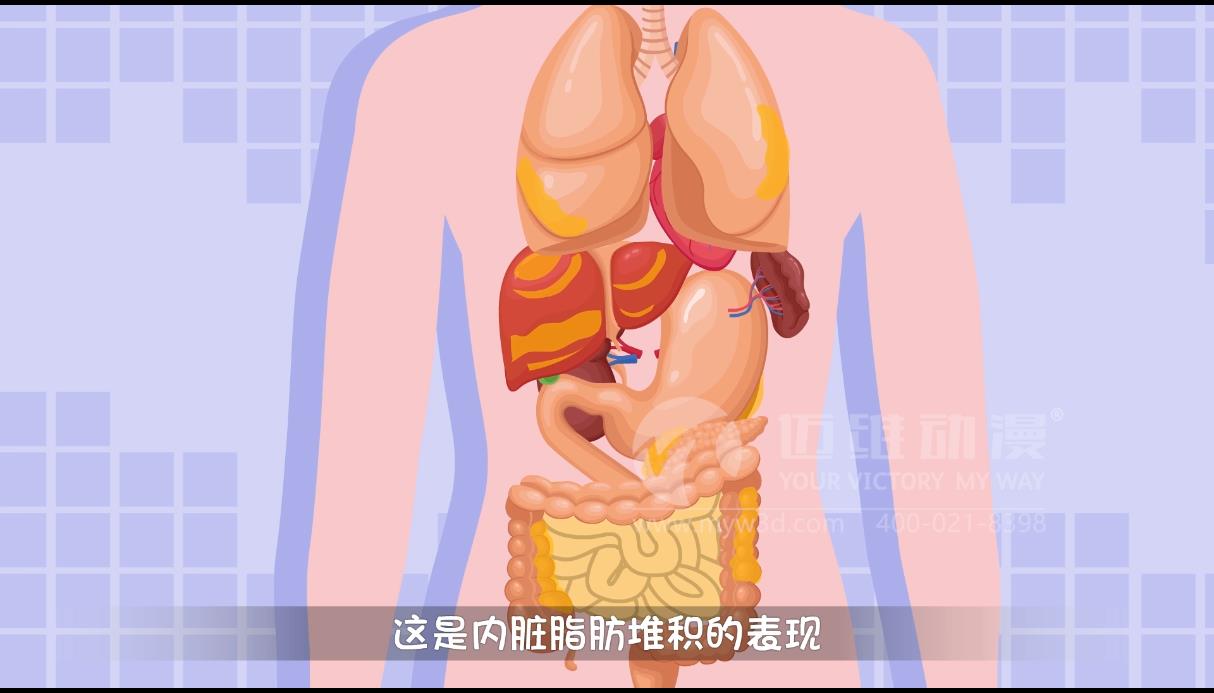 MG動畫，邁維動漫.jpg