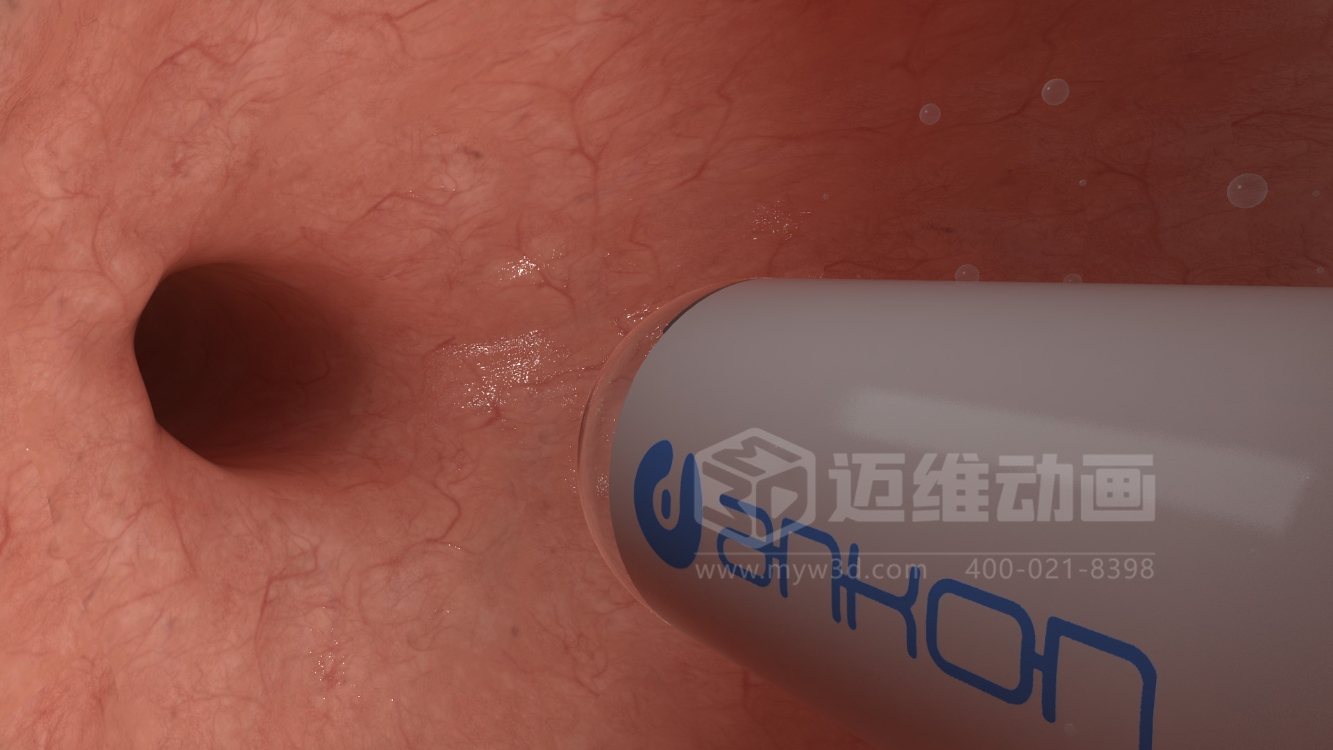 醫(yī)學(xué)檢測設(shè)備如何突破消化道檢查壁壘？三維動畫還原核心技術(shù)與臨床價(jià)值(圖4)